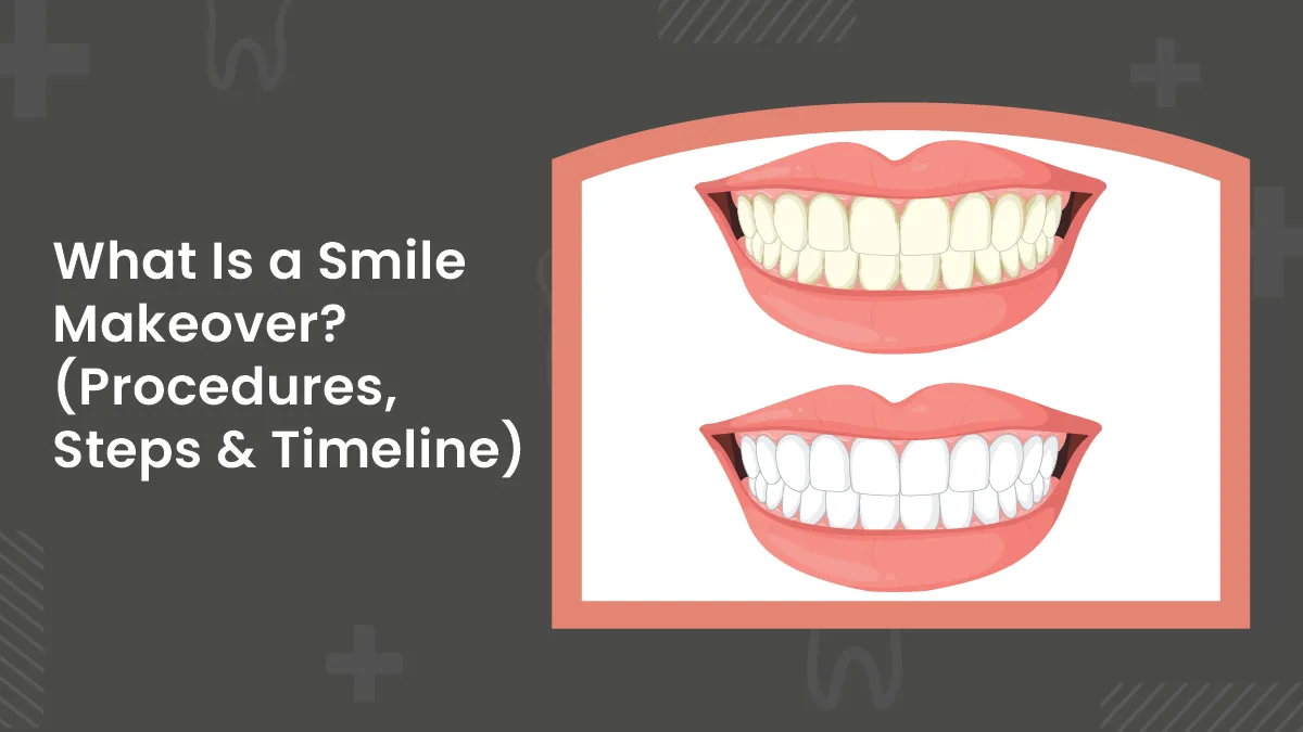 Dental Bridges vs Implants: Which Is the Better Option for You?